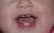 TeethingAndBiting