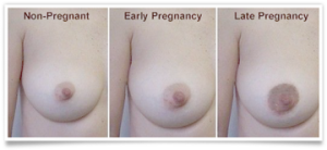 BFB Breast Pregnancy changes II