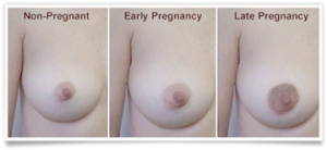 BFB Breast Pregnancy changes II