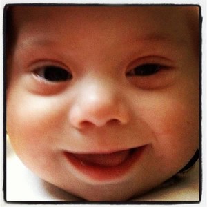 LUCAS Down Syndrome