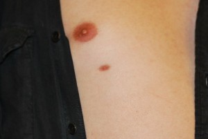 BFB Photo extra nipple