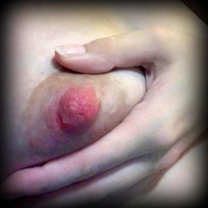 vaginal yeast infection breastfeeding Vaginal yeast infection breastfeeding